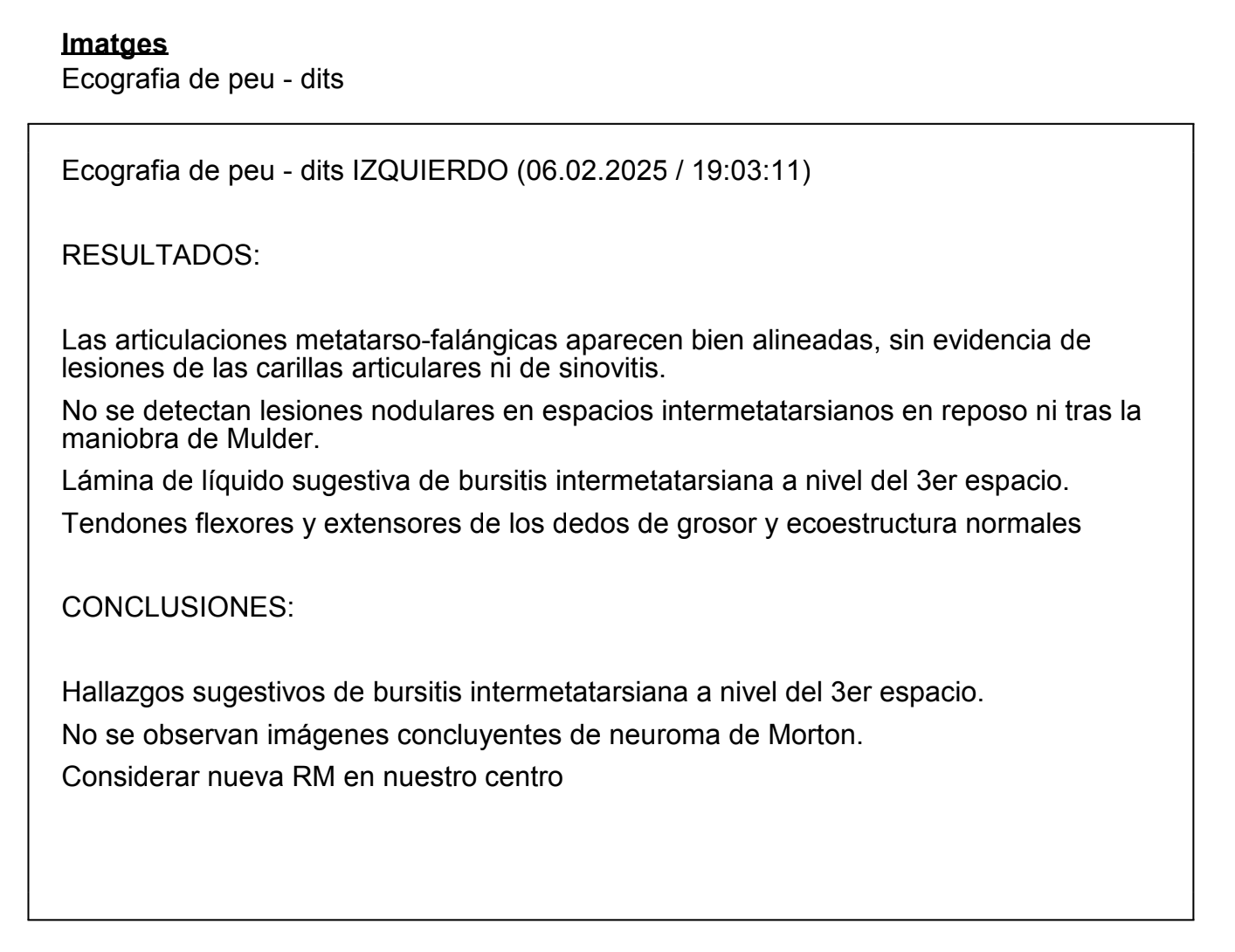Ecografía pie izquierdo prueba anterior no concluyente neuroma de Morton