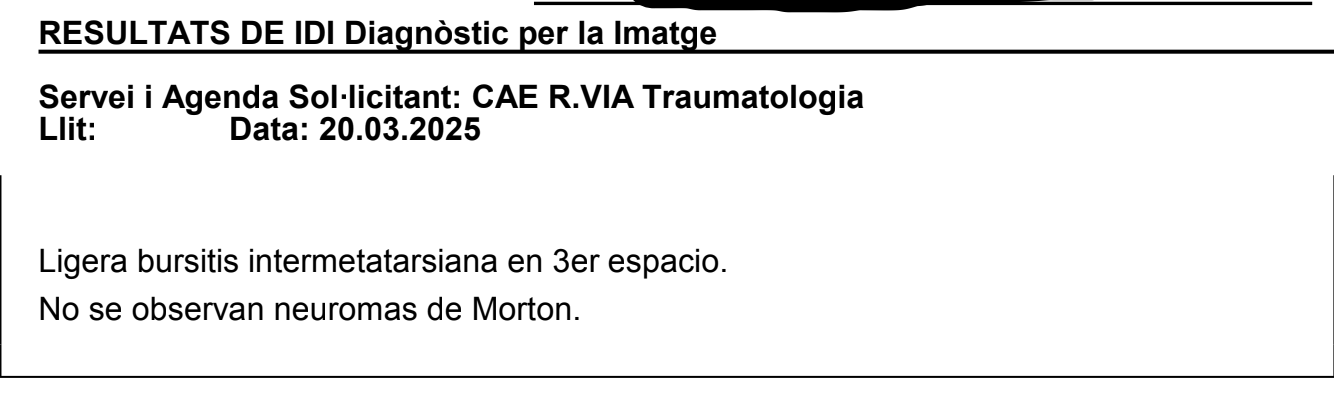 Resonancia magnética pie izquierdo prueba anterior no concluyente neuroma de Morton