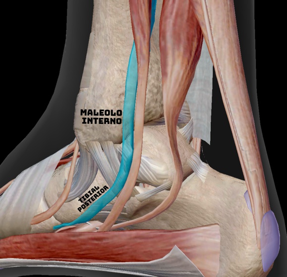 Tendinitis tibial posterior en Terrassa - Clinik Podologia